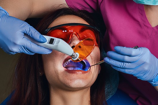 Stay in the Know: The Benefits of Laser Dentistry image