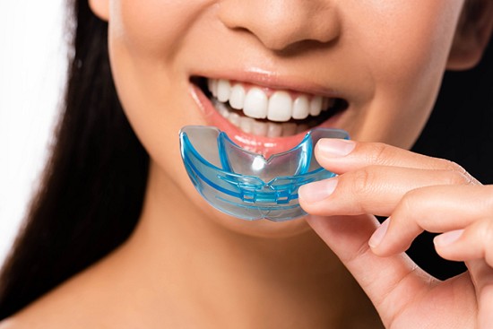 Why You Should Get a Custom Mouthguard image