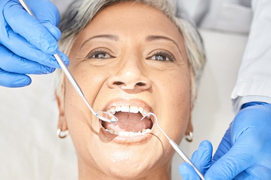 Dental Care For Seniors: Caring For Your Teeth Over 55 image