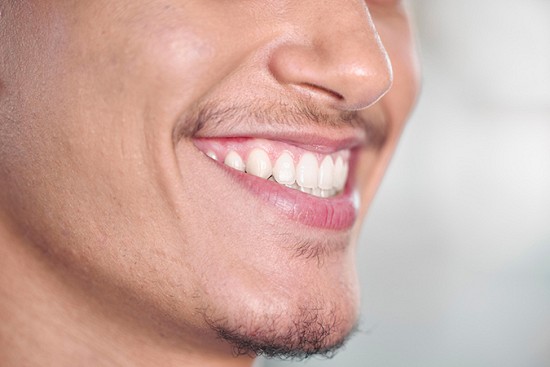 Replacing Missing Teeth image