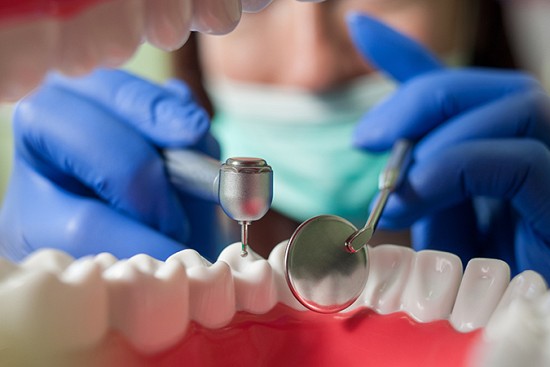 Are Dental Implants Right For You? image