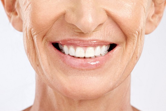 Are All-On-Four Dental Implants Right For Me? image