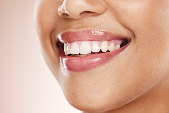 In-Office vs. Take-Home Teeth Whitening image