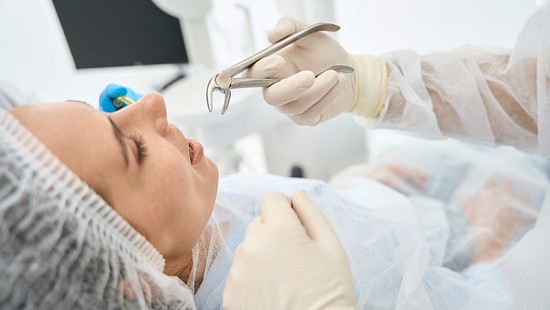 Teeth/Wisdom Teeth Extractions image