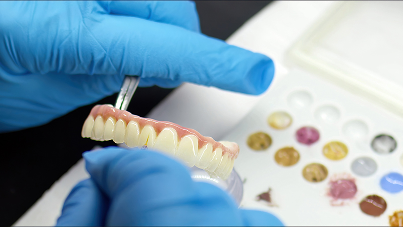 Implant Study