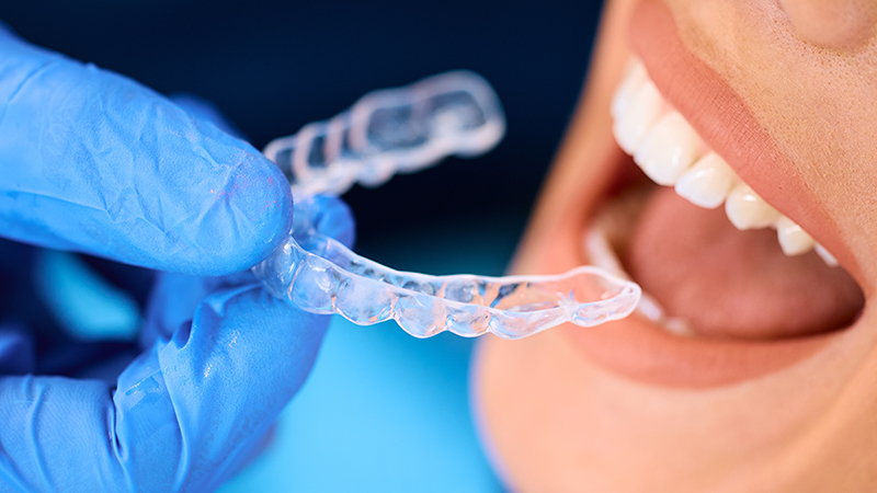 Orthodontic teeth align