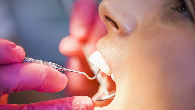 Why Do My Gums Bleed?