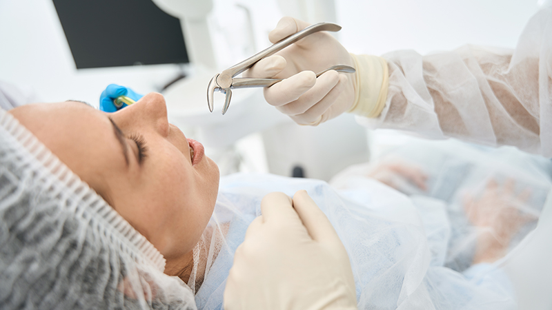 Teeth/Wisdom Teeth Extractions image