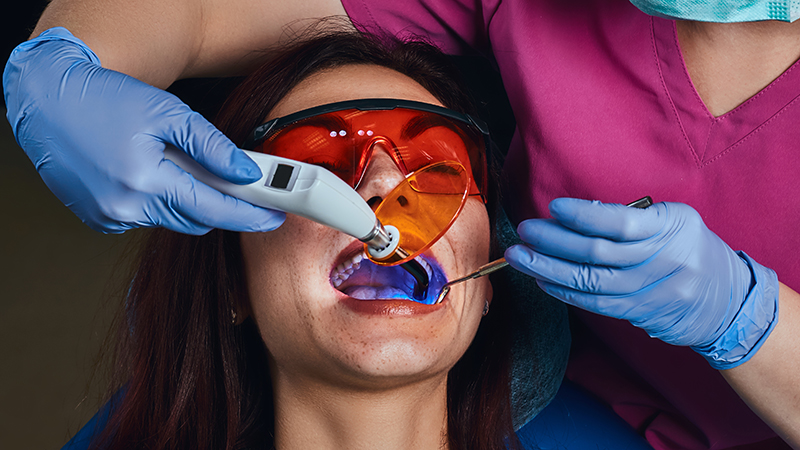 Stay in the Know: The Benefits of Laser Dentistry