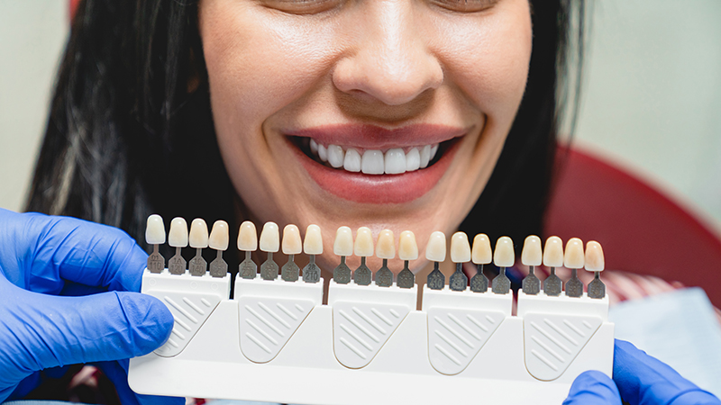 Transform Your Smile With Porcelain Veneers