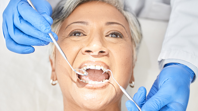 Dental Care For Seniors: Caring For Your Teeth Over 55