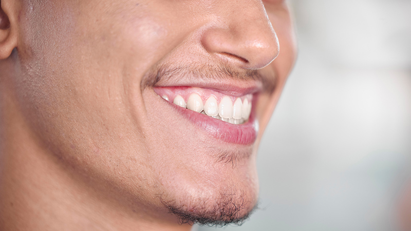 Replacing Missing Teeth