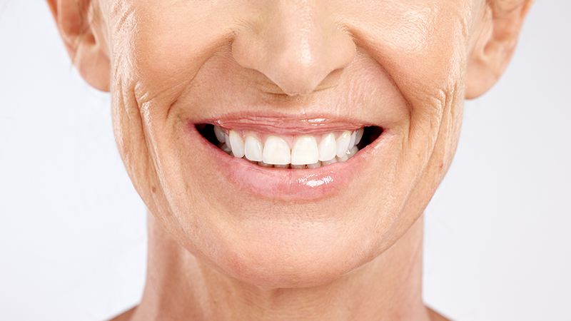 Are All-On-Four Dental Implants Right For Me?